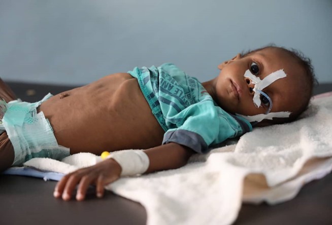 Yemen's situation is about to get worse